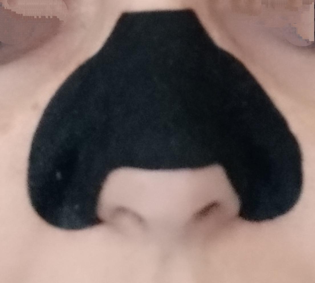 Punti neri via in 15 minuti